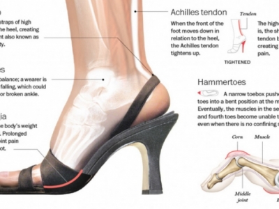 High Heels Can Lead To A Dozen Foot And Leg Injuries